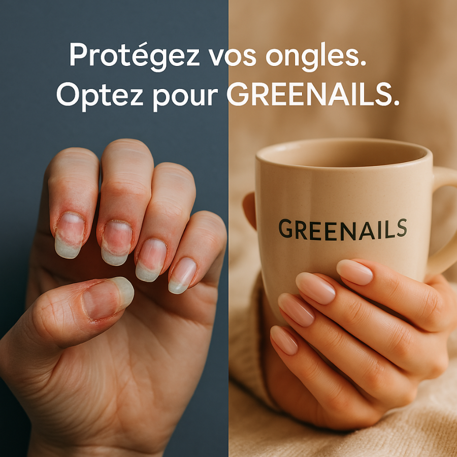 Des Faux Ongles Sublimes en 5 min – Sans Colle, Sans dégâts, Sans RDV - Rouge Glamour Fleurie